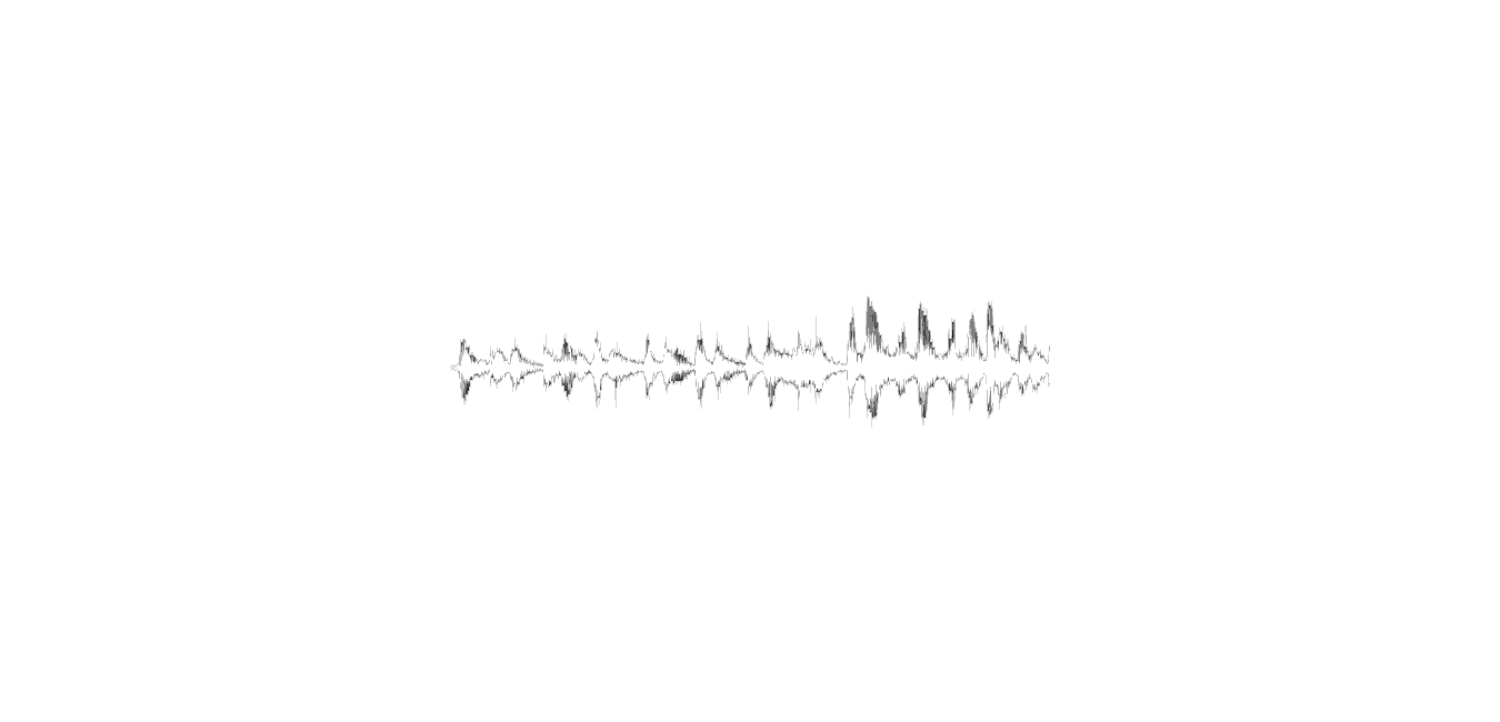 waveform